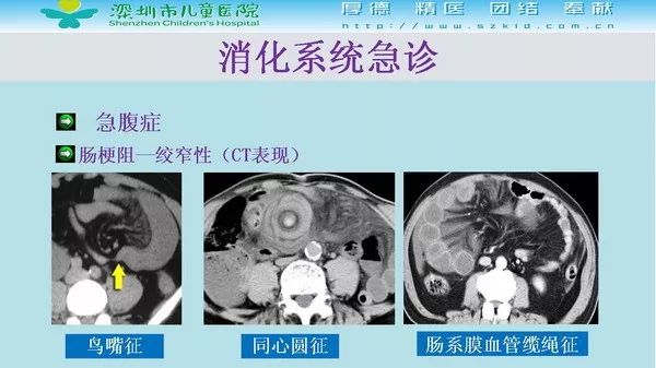 【PPT】影像检查在儿童急诊的应用价值