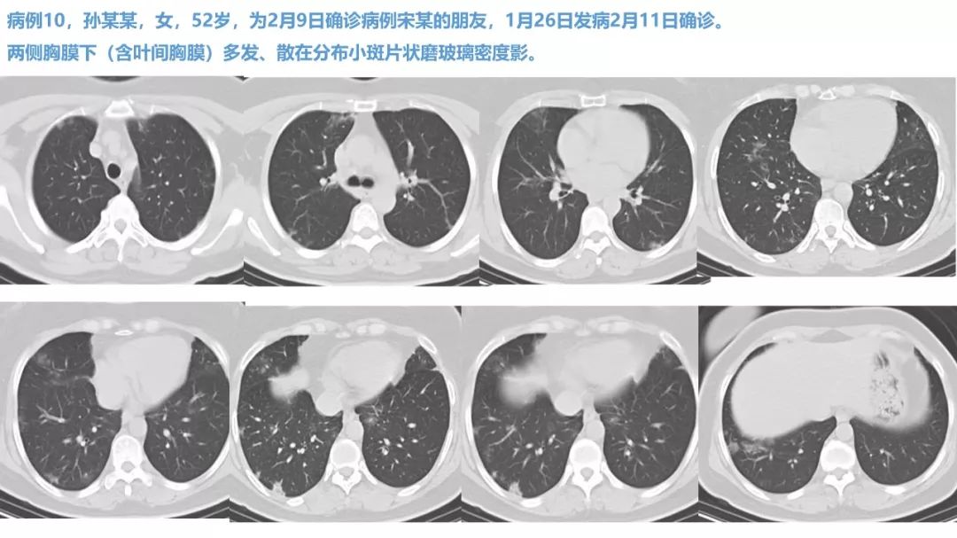 【PPT】新型冠状病毒肺炎NCP确诊病例汇总