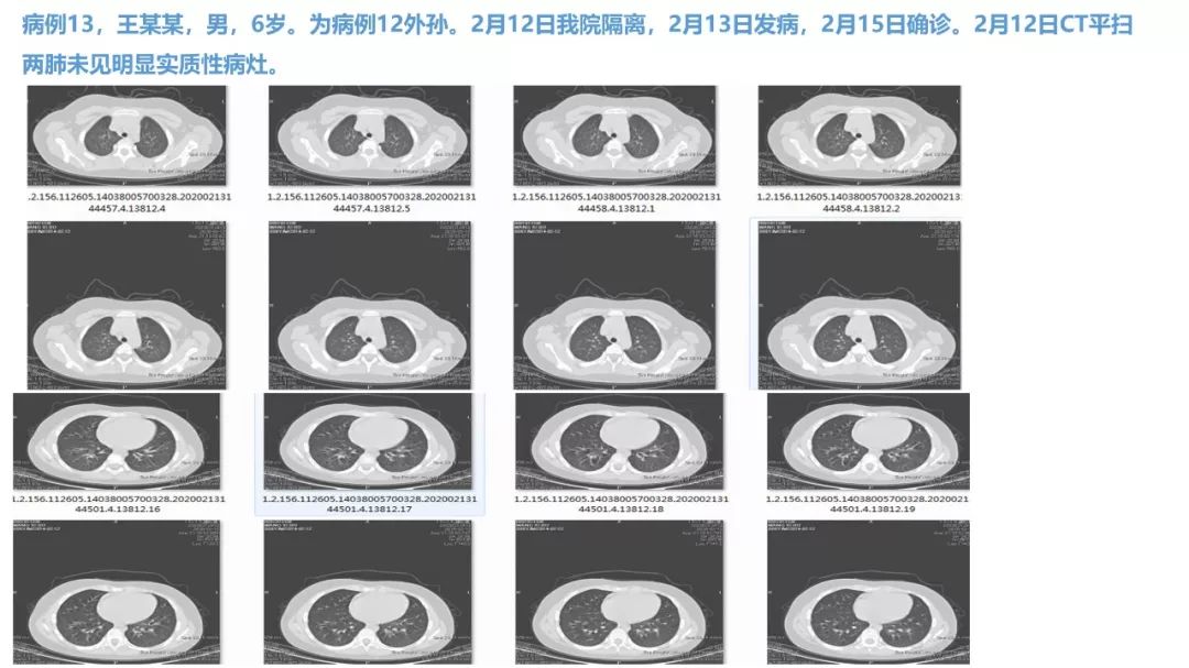 【PPT】新型冠状病毒肺炎NCP确诊病例汇总