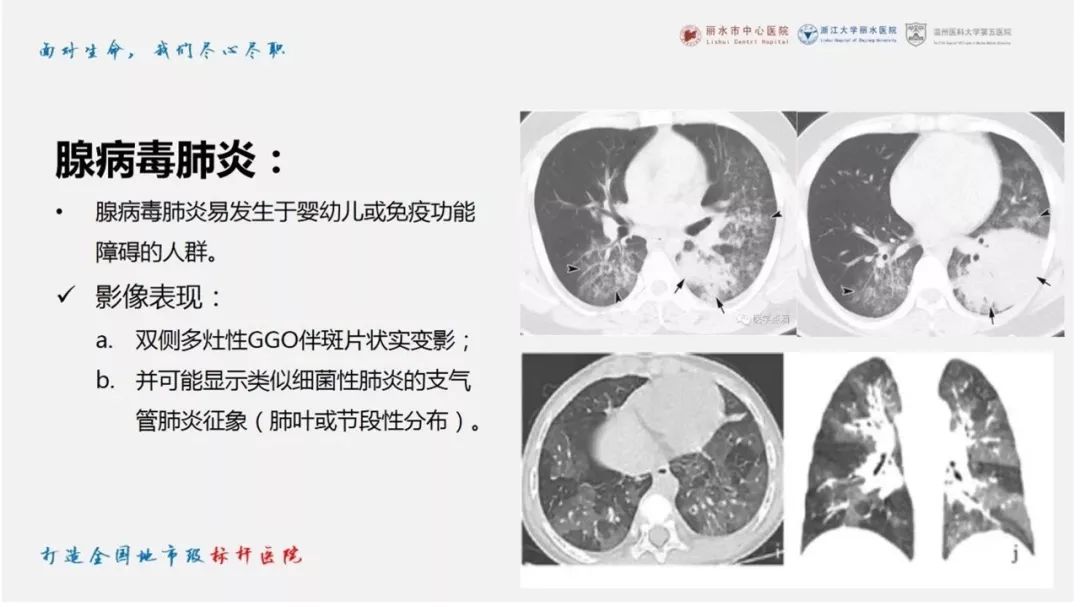【PPT】新型冠状病毒肺炎NCP确诊病例汇总