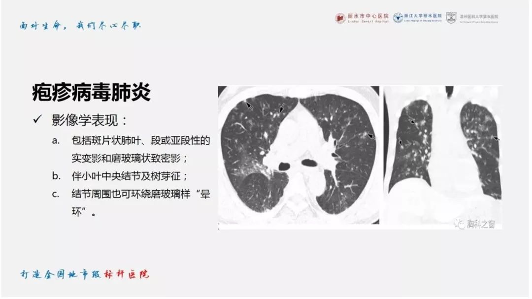 【PPT】新型冠状病毒肺炎NCP确诊病例汇总