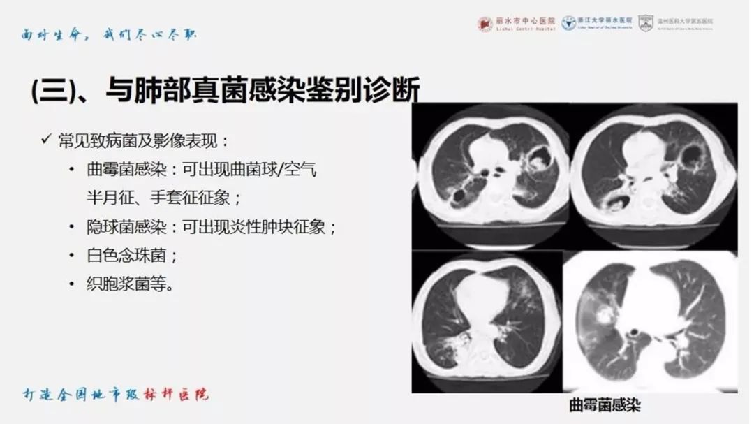 【PPT】新型冠状病毒肺炎NCP确诊病例汇总