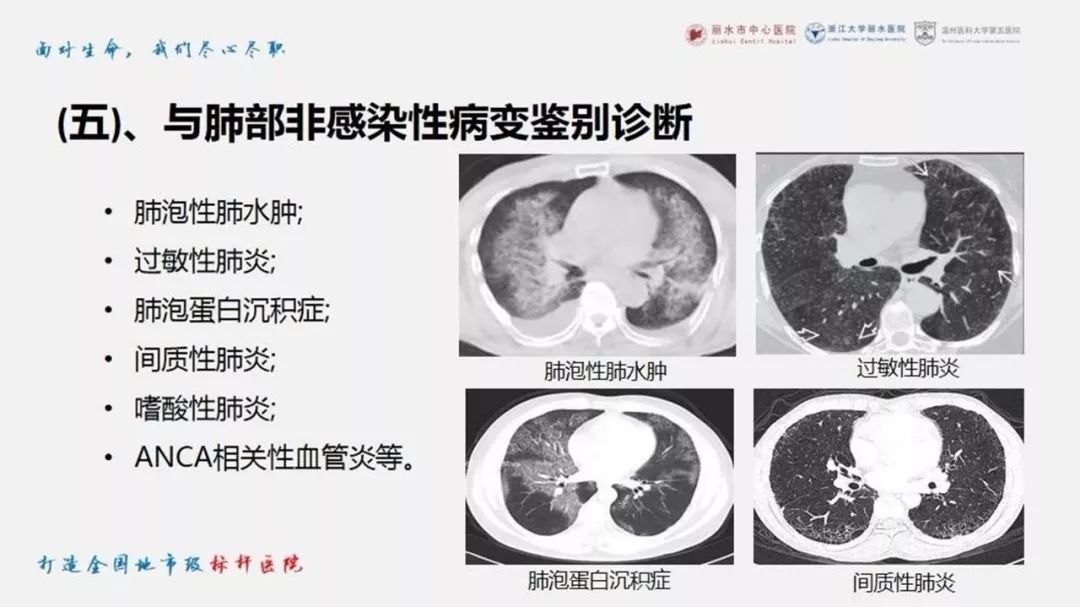 【PPT】新型冠状病毒肺炎NCP确诊病例汇总