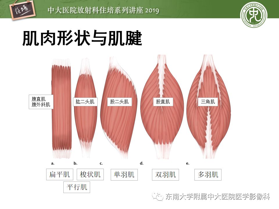 【PPT】创伤性肌肉病变的MR诊断
