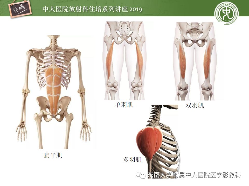 【PPT】创伤性肌肉病变的MR诊断