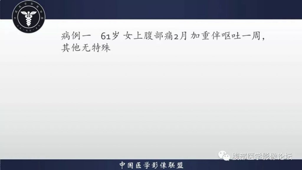【病例】胃窦弥漫性大B细胞淋巴瘤1例CT影像