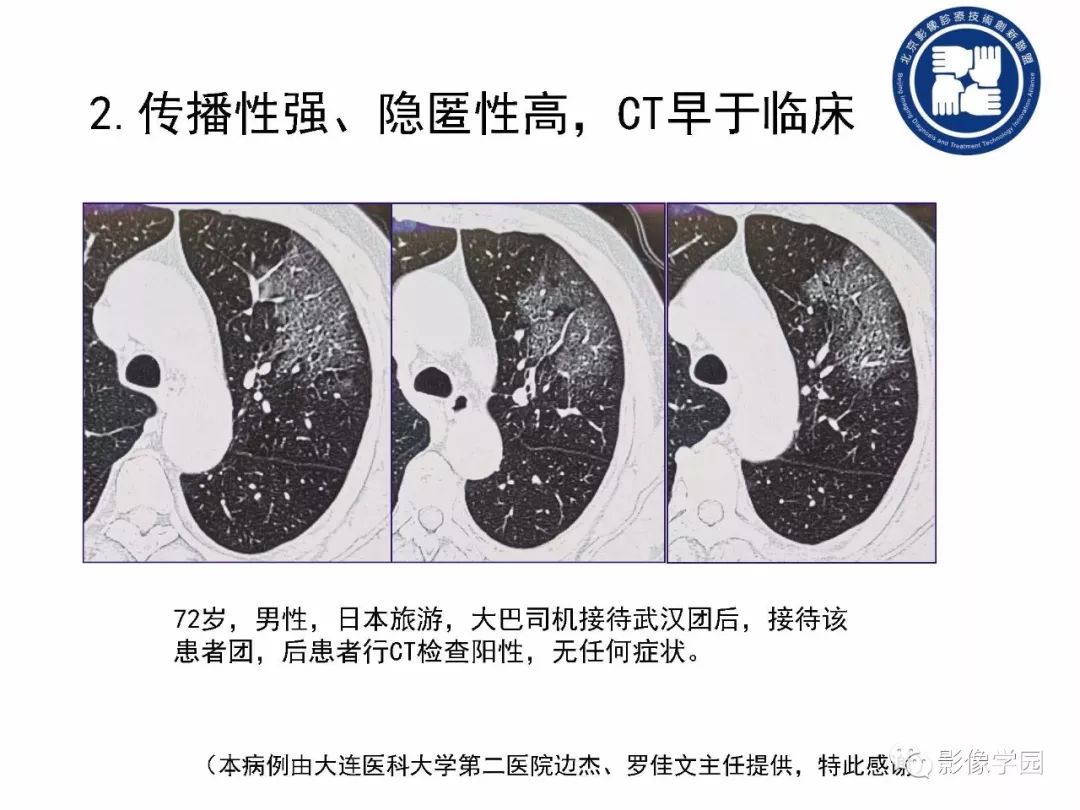 【PPT】新型冠状病毒肺炎影像学诊断指南解读