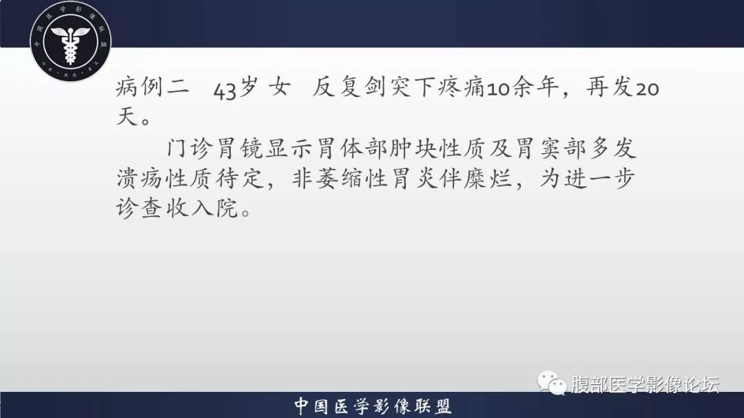 【病例】胃体神经鞘瘤1例CT影像
