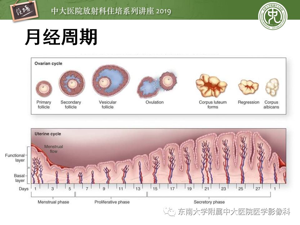 【PPT】卵巢急腹症影像学表现