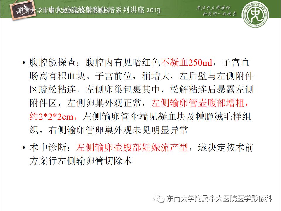 【PPT】卵巢急腹症影像学表现
