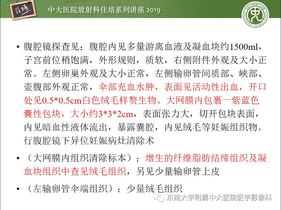 【PPT】卵巢急腹症影像学表现