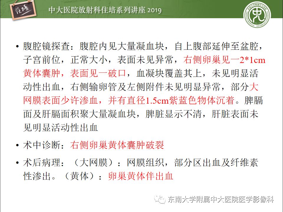 【PPT】卵巢急腹症影像学表现