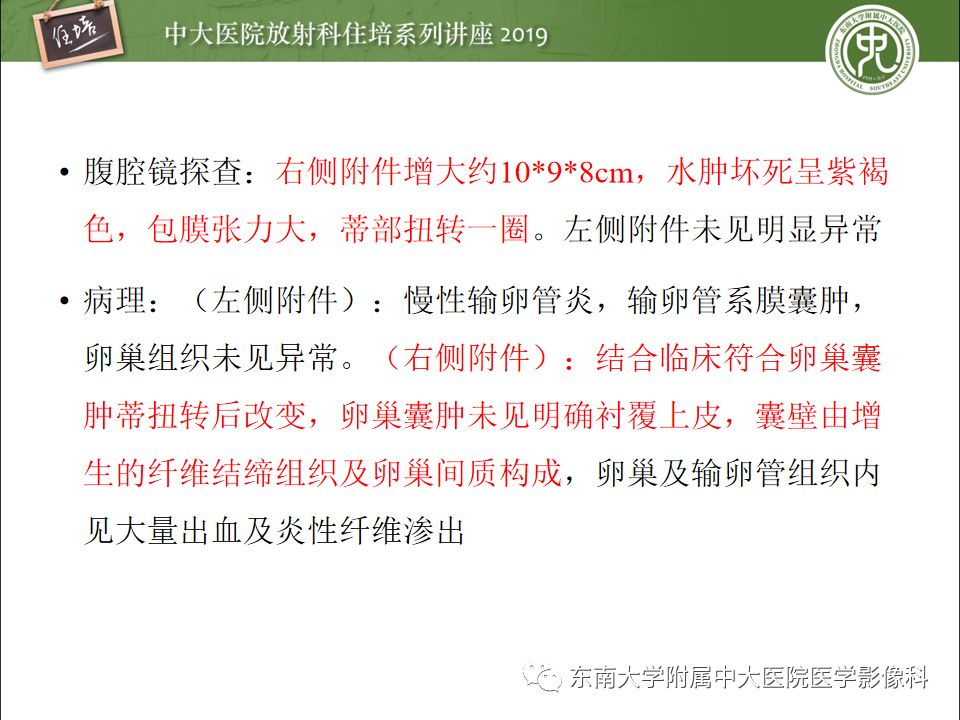 【PPT】卵巢急腹症影像学表现