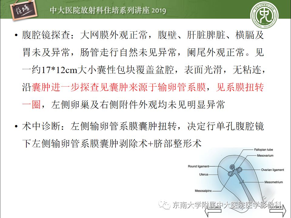 【PPT】卵巢急腹症影像学表现