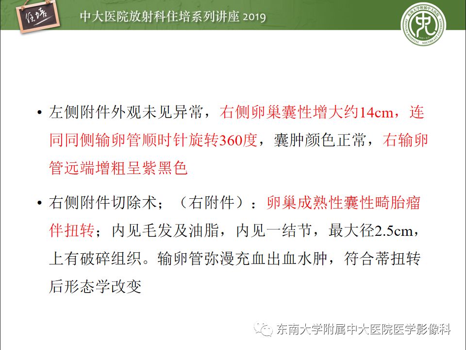 【PPT】卵巢急腹症影像学表现