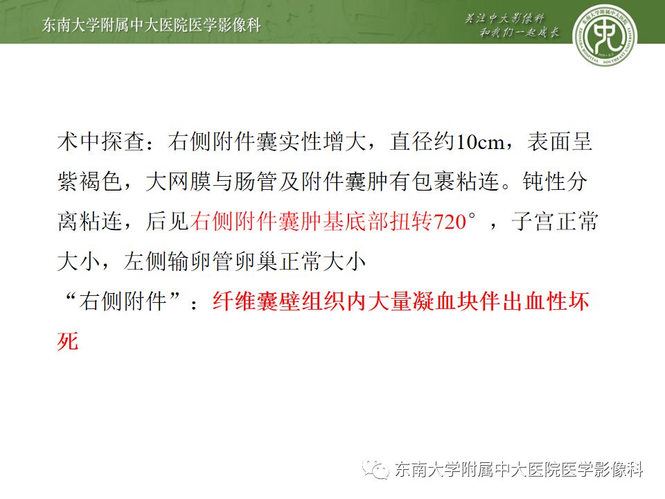 【PPT】卵巢急腹症影像学表现