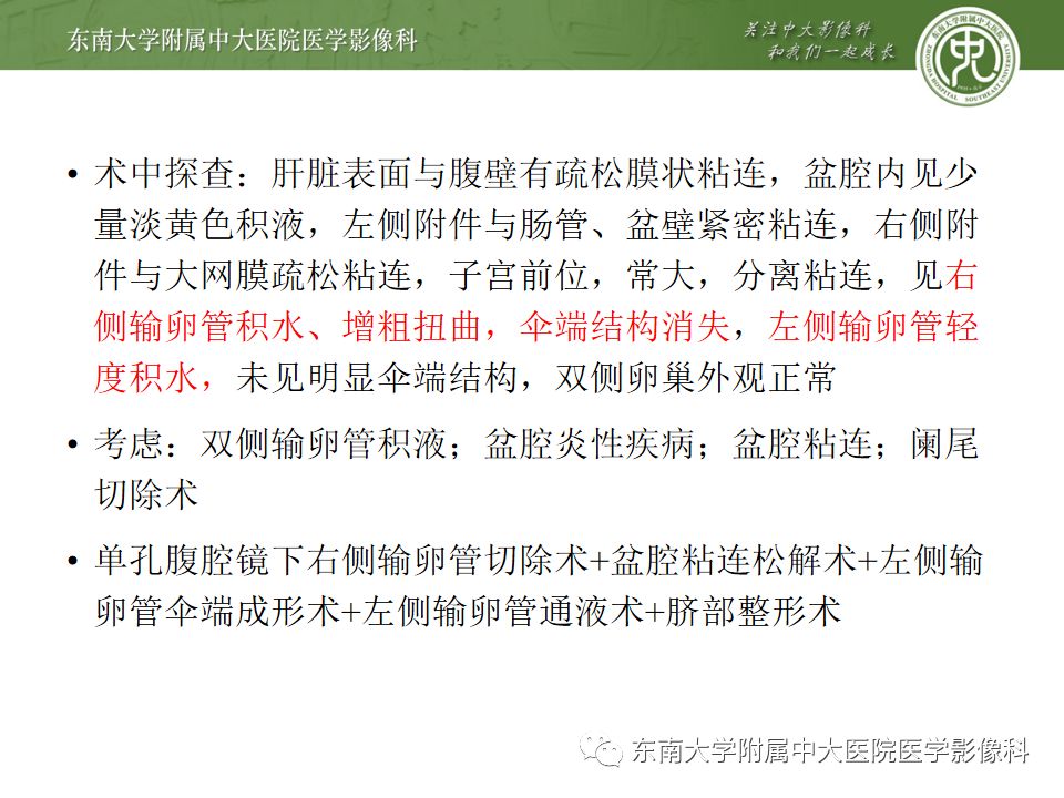 【PPT】卵巢急腹症影像学表现