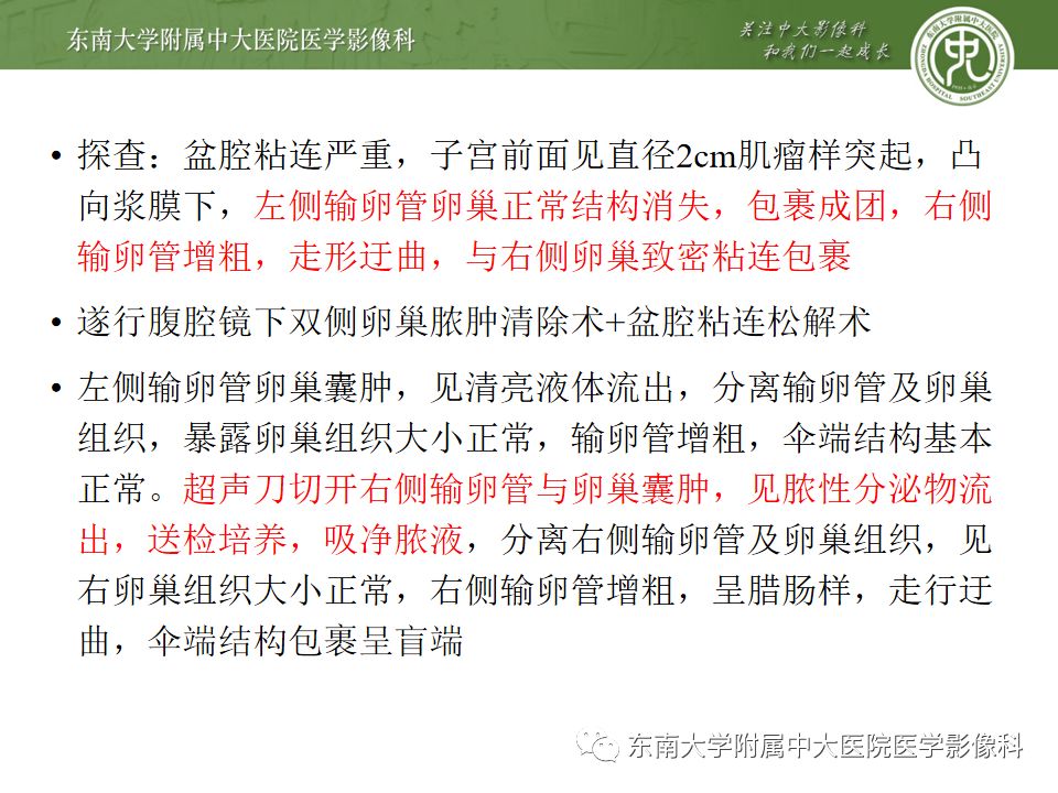 【PPT】卵巢急腹症影像学表现