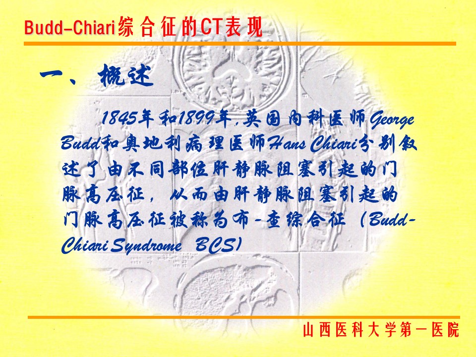 布加综合征CT表现