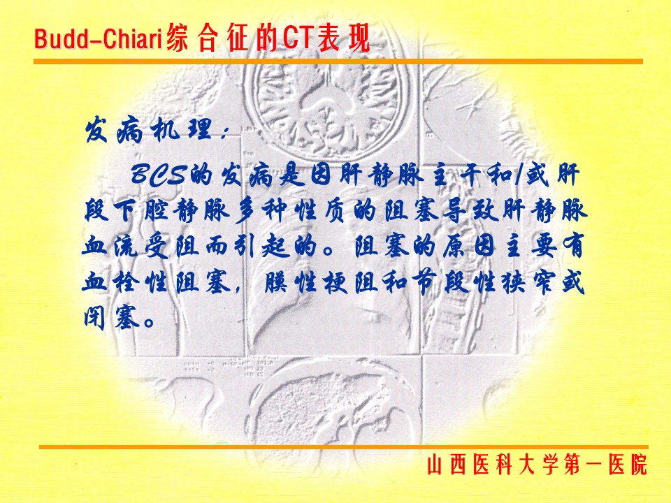 布加综合征CT表现