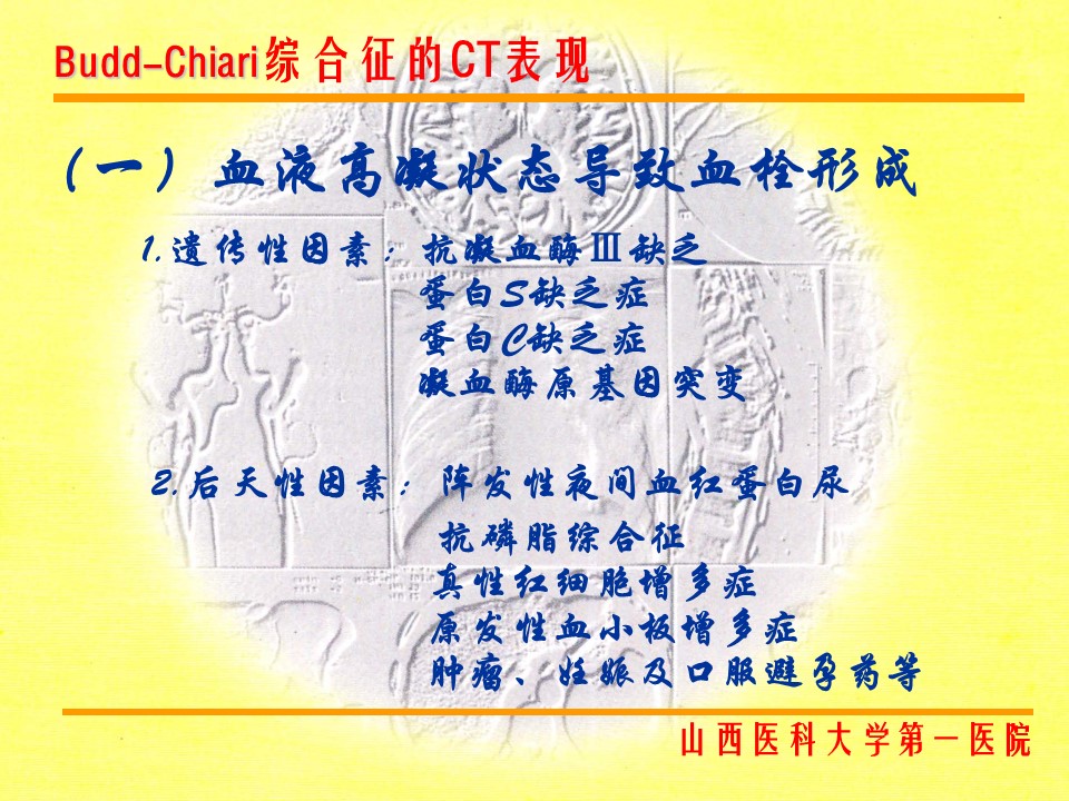 布加综合征CT表现