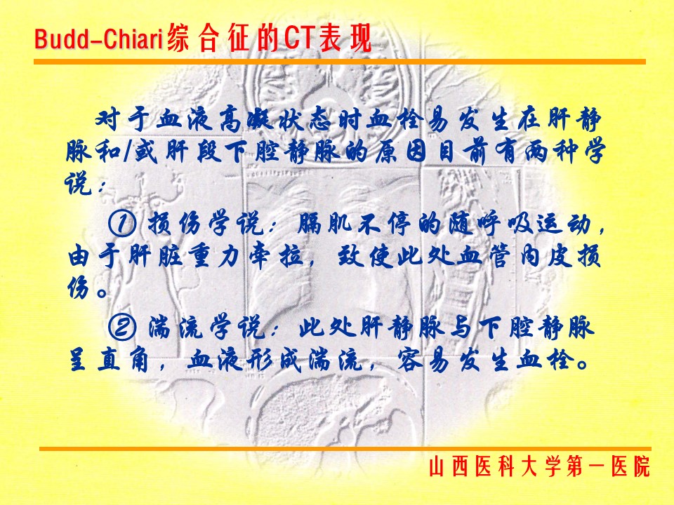 布加综合征CT表现