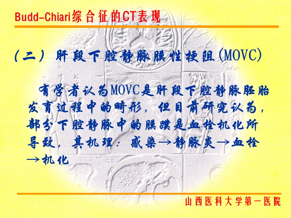 布加综合征CT表现