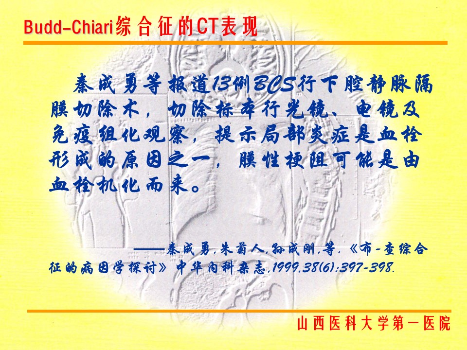 布加综合征CT表现
