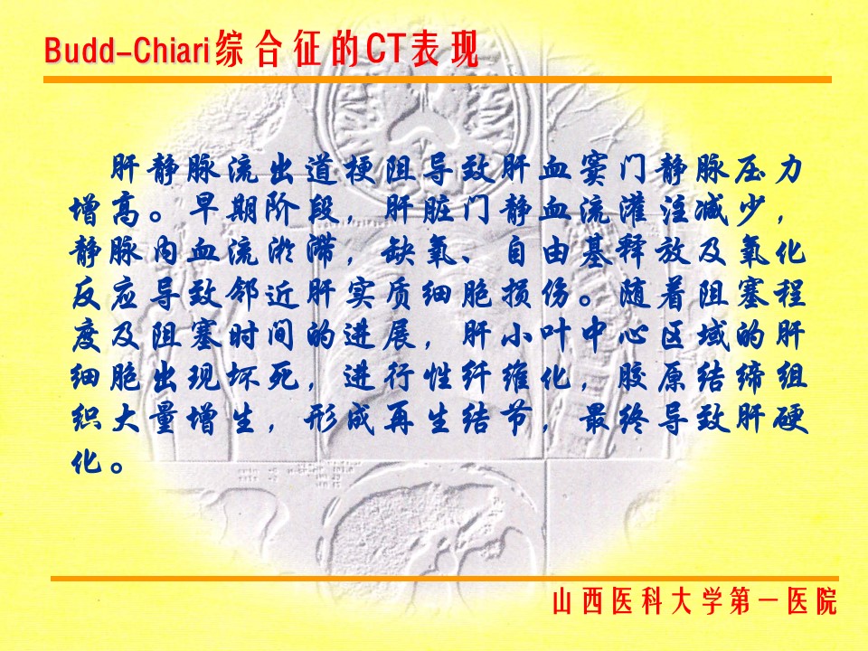 布加综合征CT表现