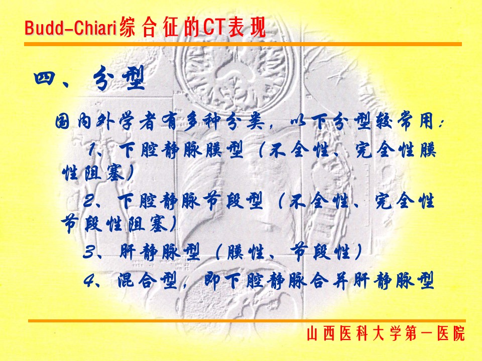 布加综合征CT表现