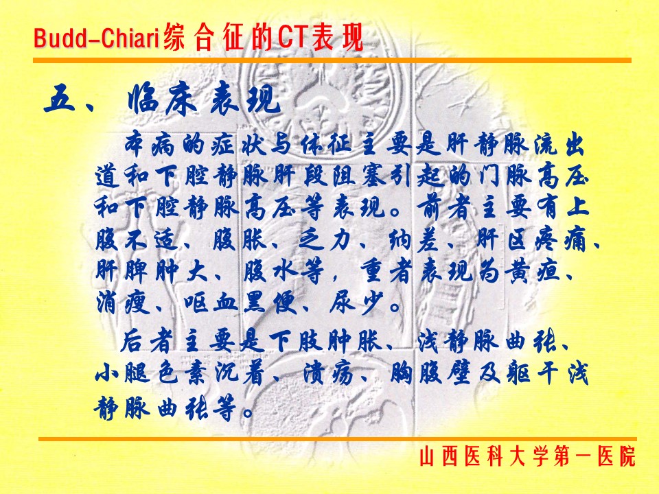 布加综合征CT表现
