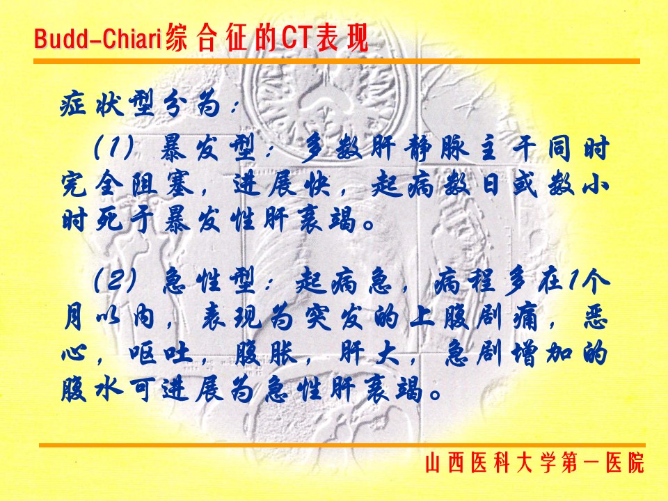 布加综合征CT表现