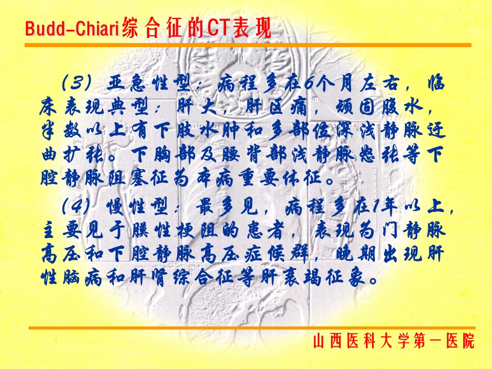 布加综合征CT表现
