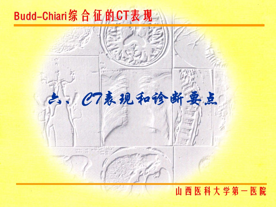 布加综合征CT表现