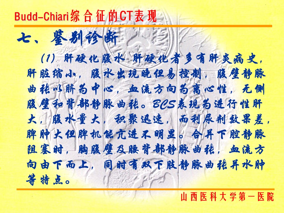 布加综合征CT表现