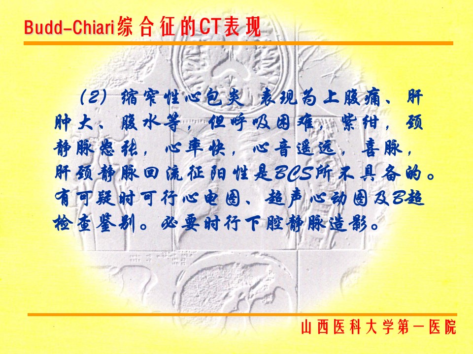 布加综合征CT表现