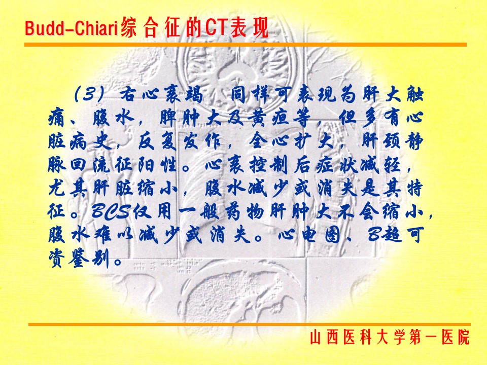 布加综合征CT表现
