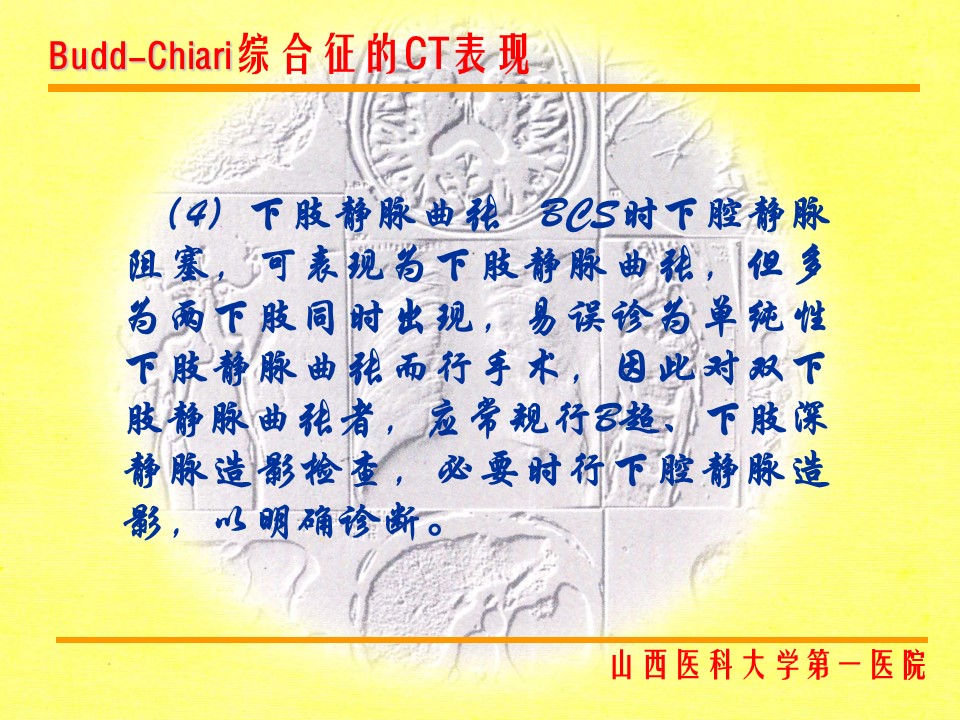 布加综合征CT表现