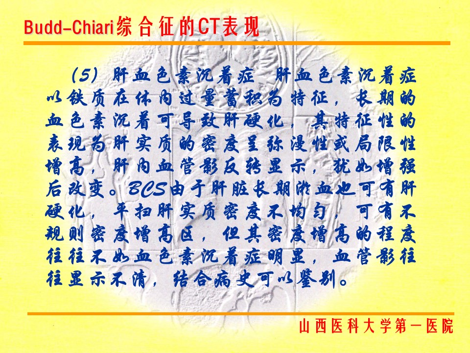 布加综合征CT表现