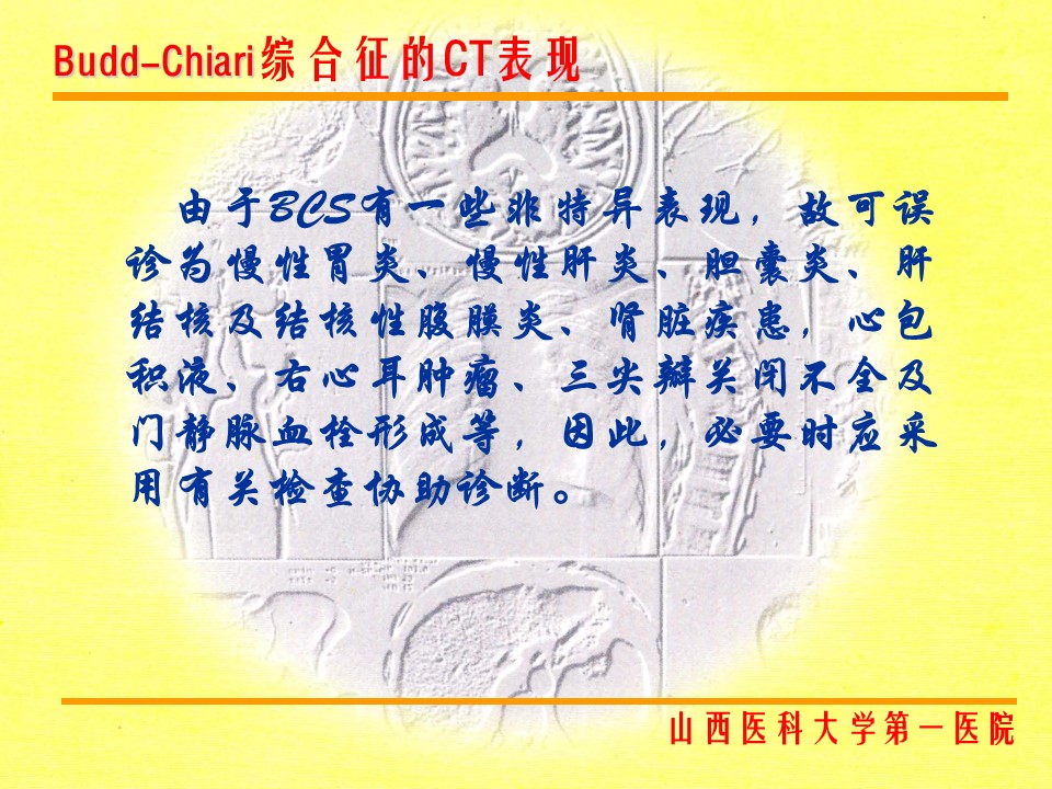 布加综合征CT表现