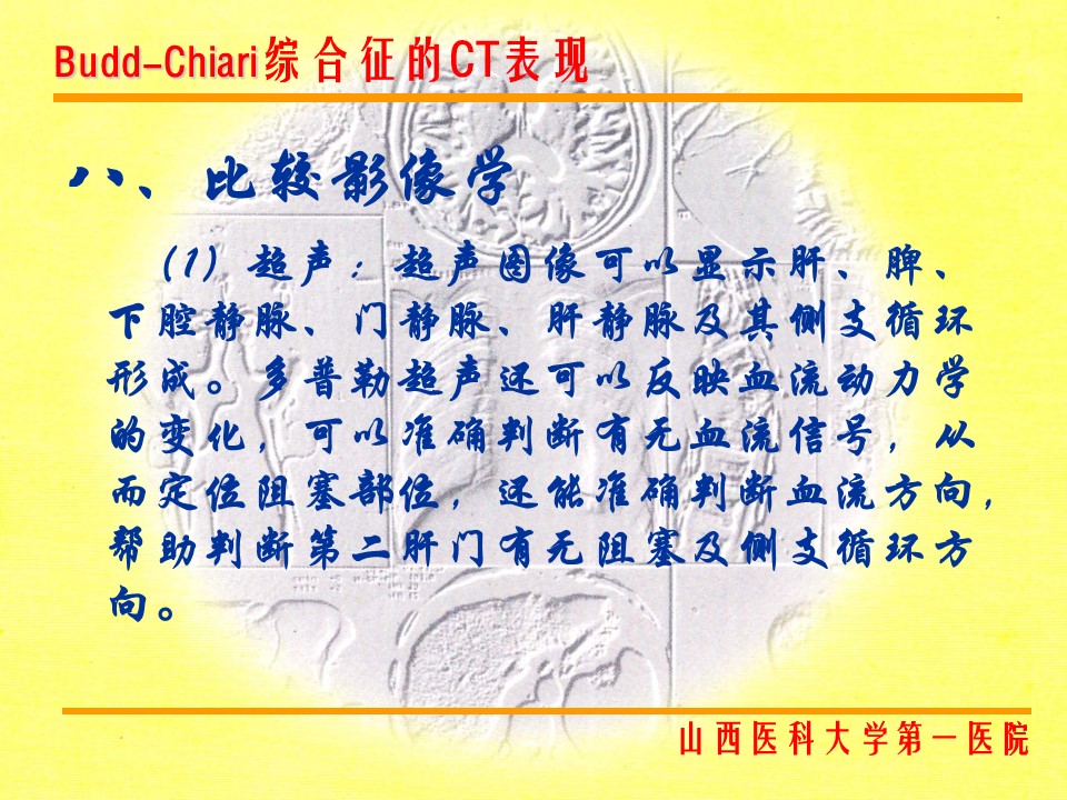 布加综合征CT表现