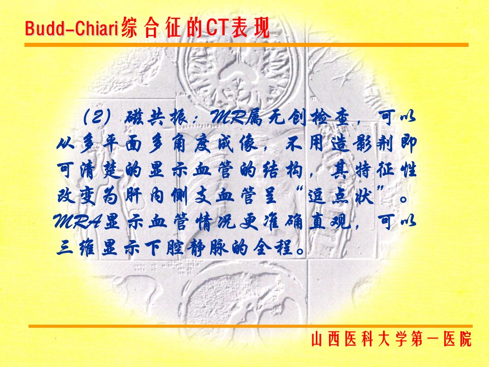 布加综合征CT表现
