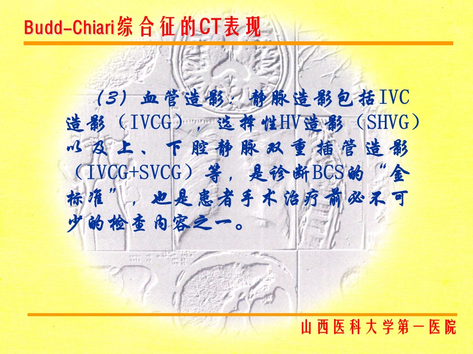 布加综合征CT表现