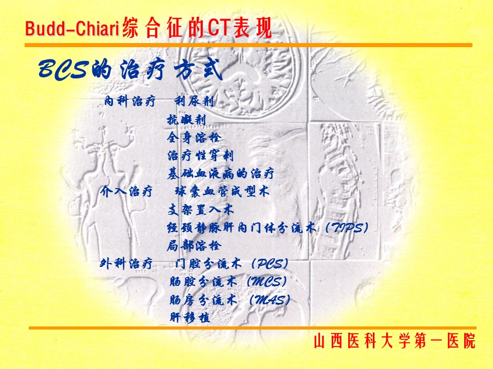 布加综合征CT表现