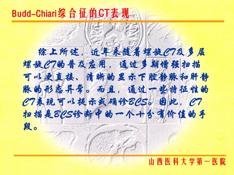 布加综合征CT表现