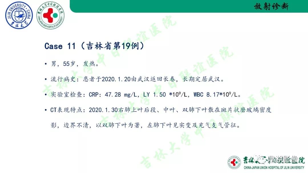 【PPT】关于新型冠状病毒肺炎放射检查流程、感控及诊断的建议