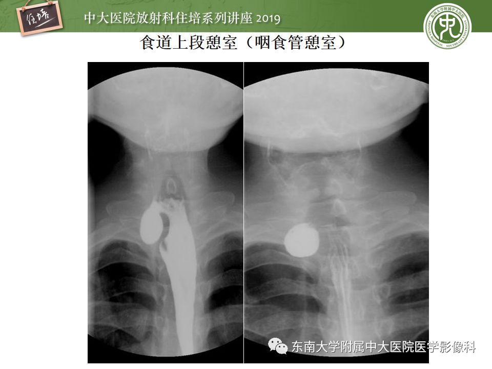 【PPT】食管常见疾病的诊断和鉴别诊断