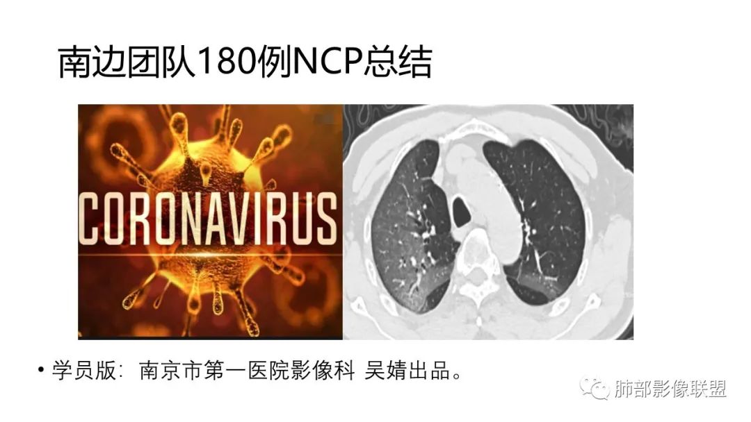 【PPT】南边团队180例NCP新型冠状病毒肺炎总结
