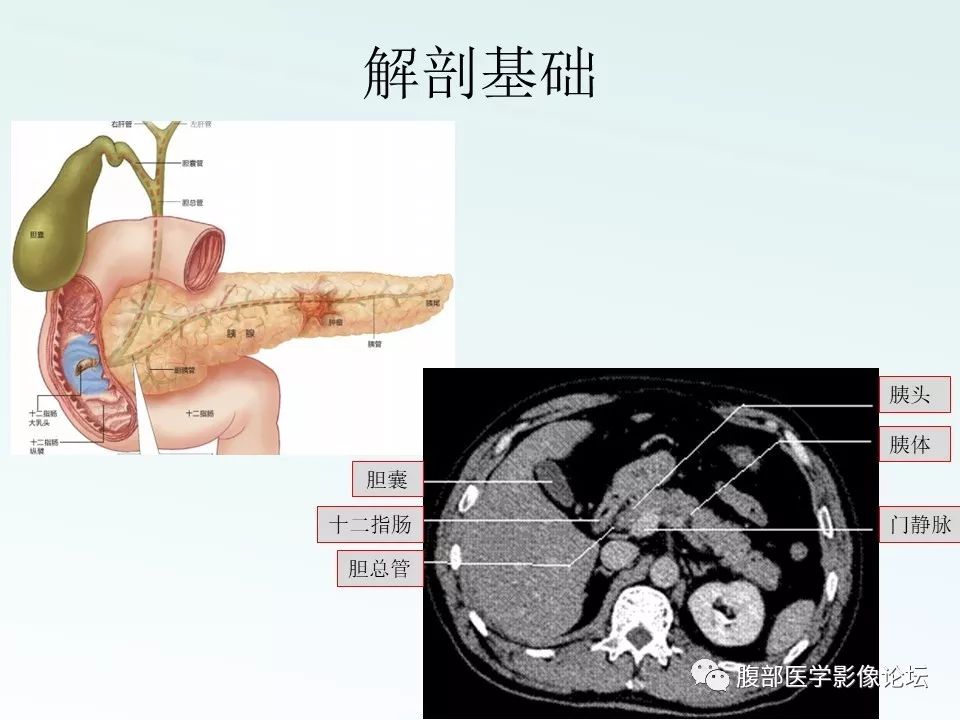 【PPT】沟槽性胰腺炎 【PPT】沟槽性胰腺炎