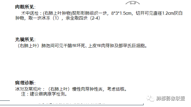 【病例】凶相毕露的肺结节1例CT影像讨论 【病例】凶相毕露的肺结节1例CT影像讨论